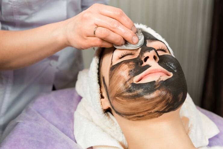 chemical peel for acne scars North Olmsted